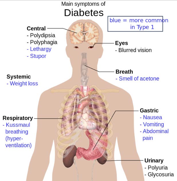 Diabetes research paper